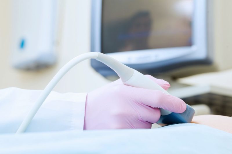 ultrasound