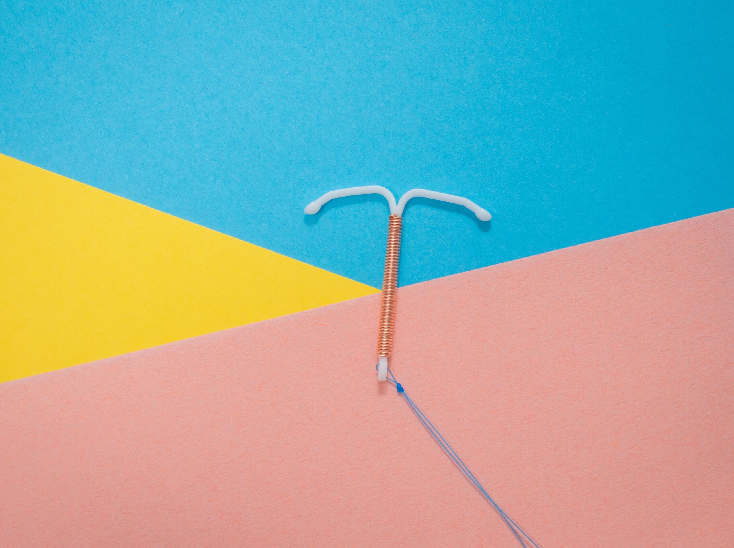 Image of an intrauterine device
